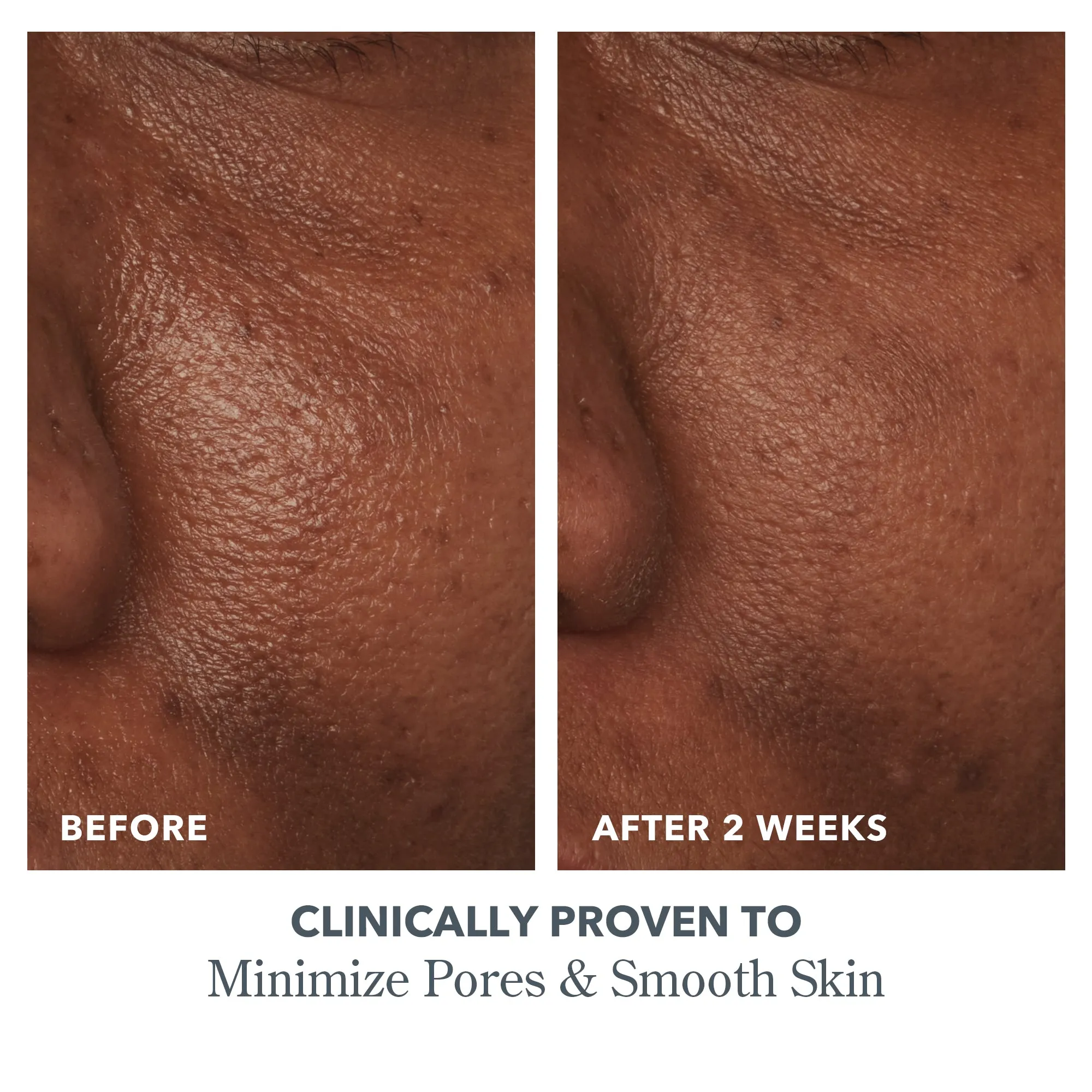 Scrub & Peel Skincare Set