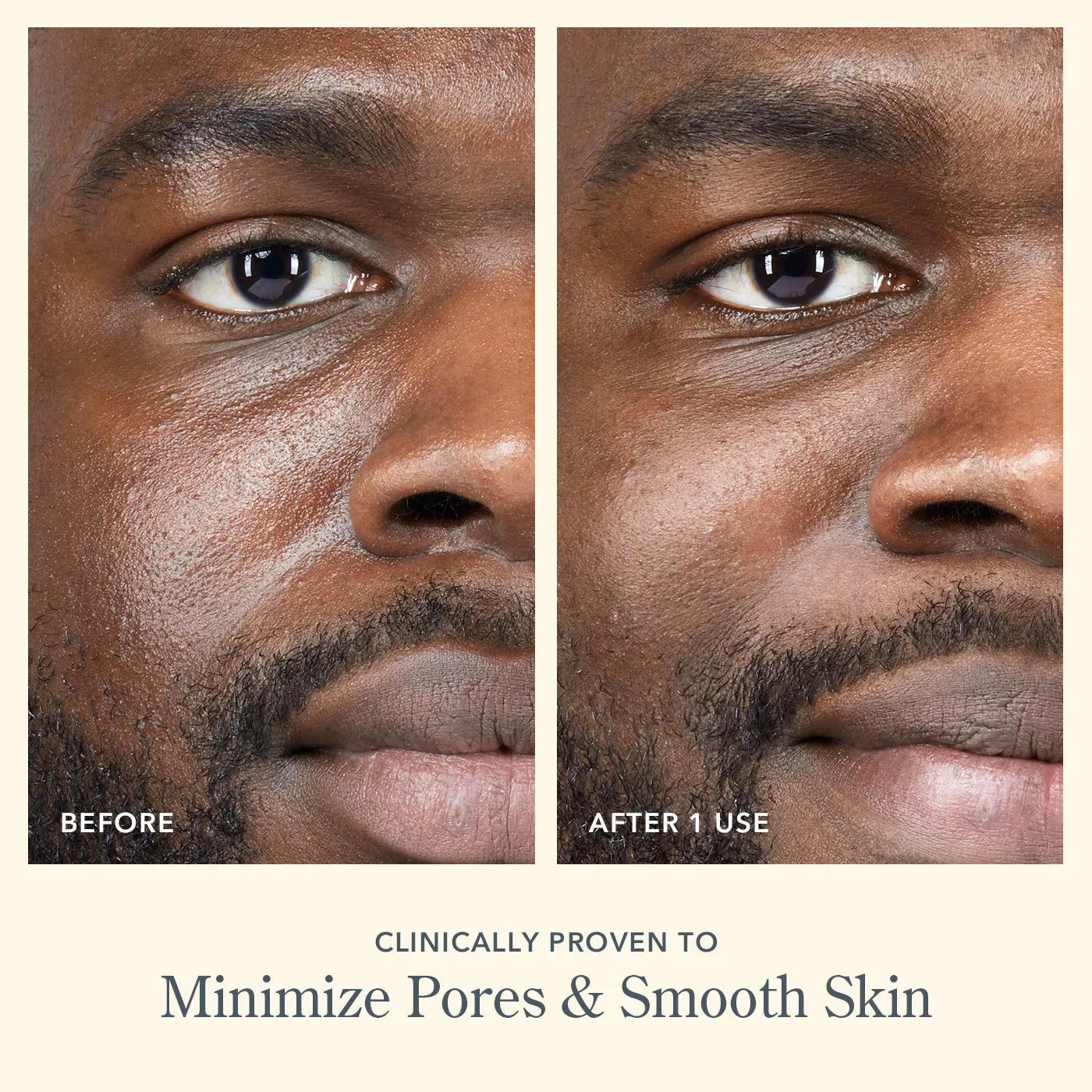Scrub & Peel Skincare Set